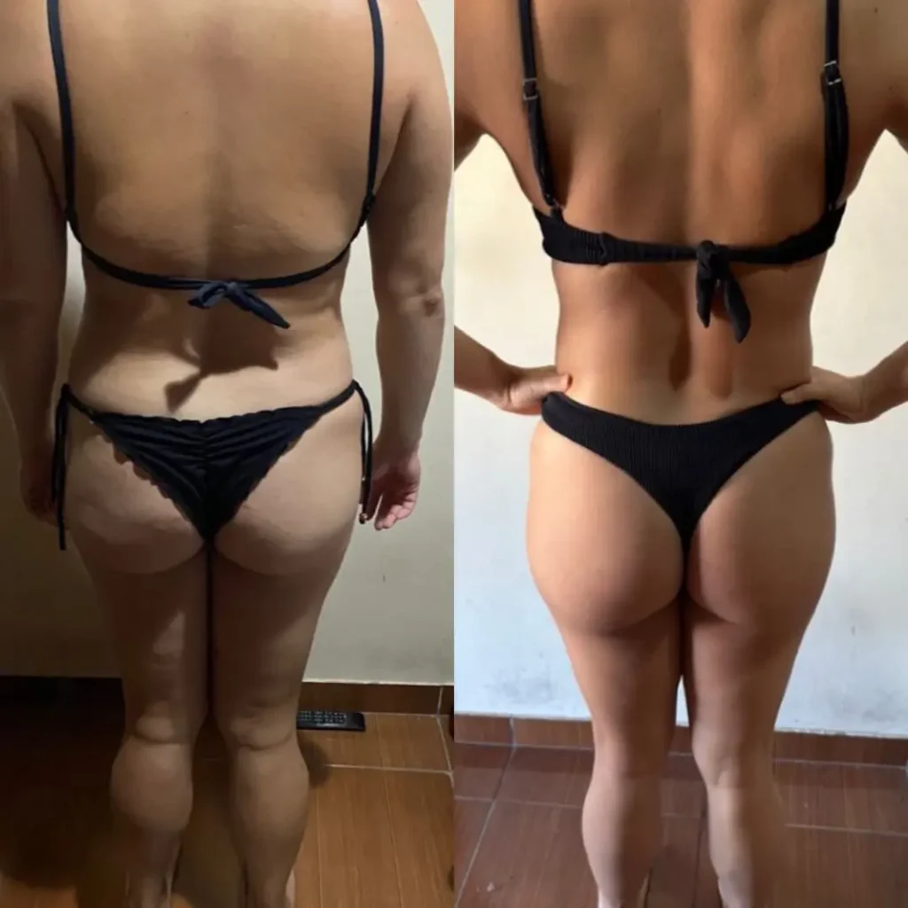 Antes e Depois 02 mulher