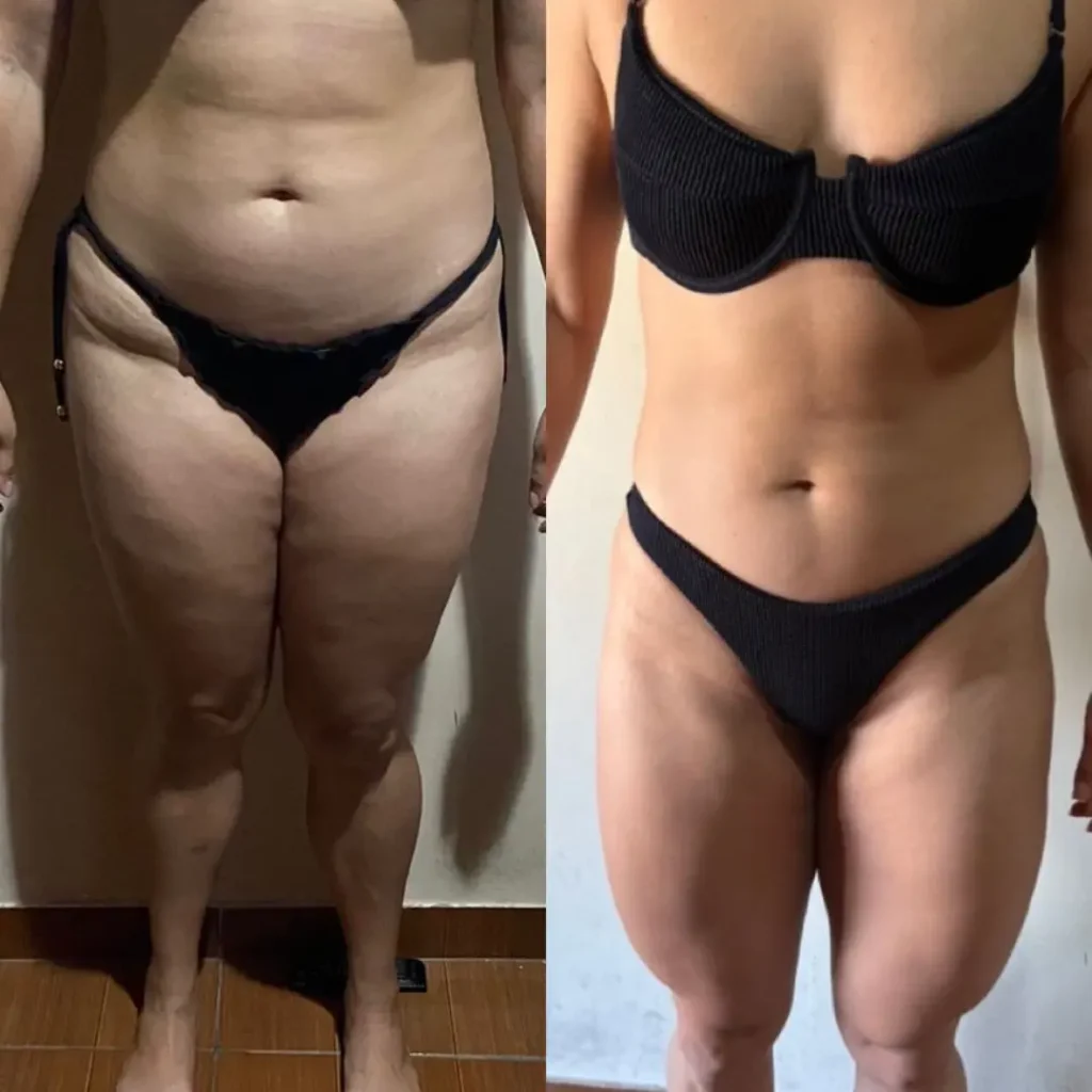 Antes e Depois 04 mulher