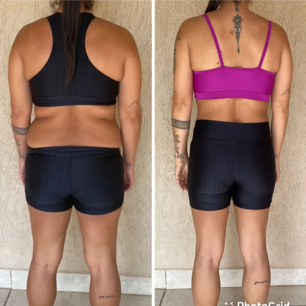 Antes e Depois 05 mulher