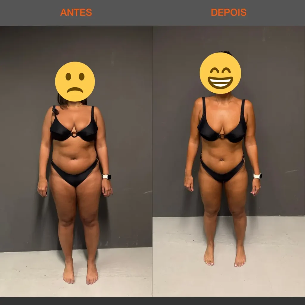 Antes e Depois 06 mulher