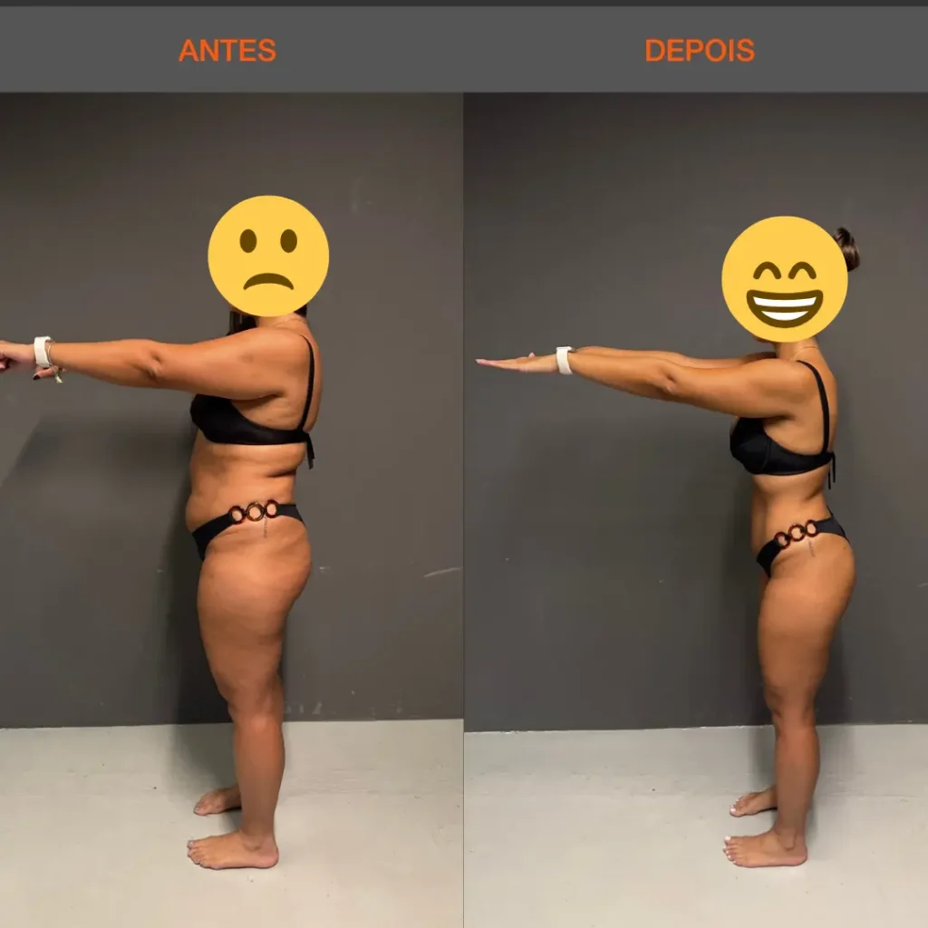 Antes e Depois 07 mulher