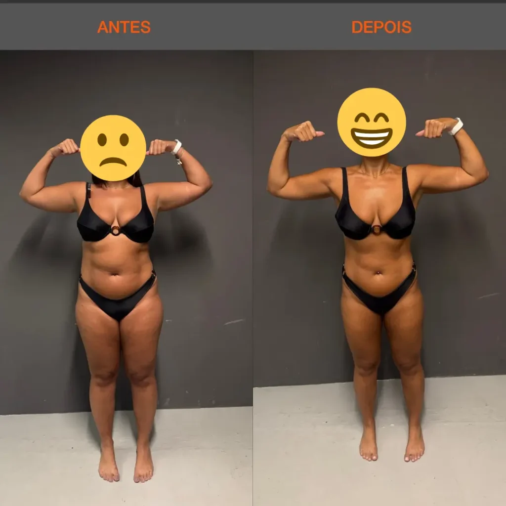 Antes e Depois 08 mulher