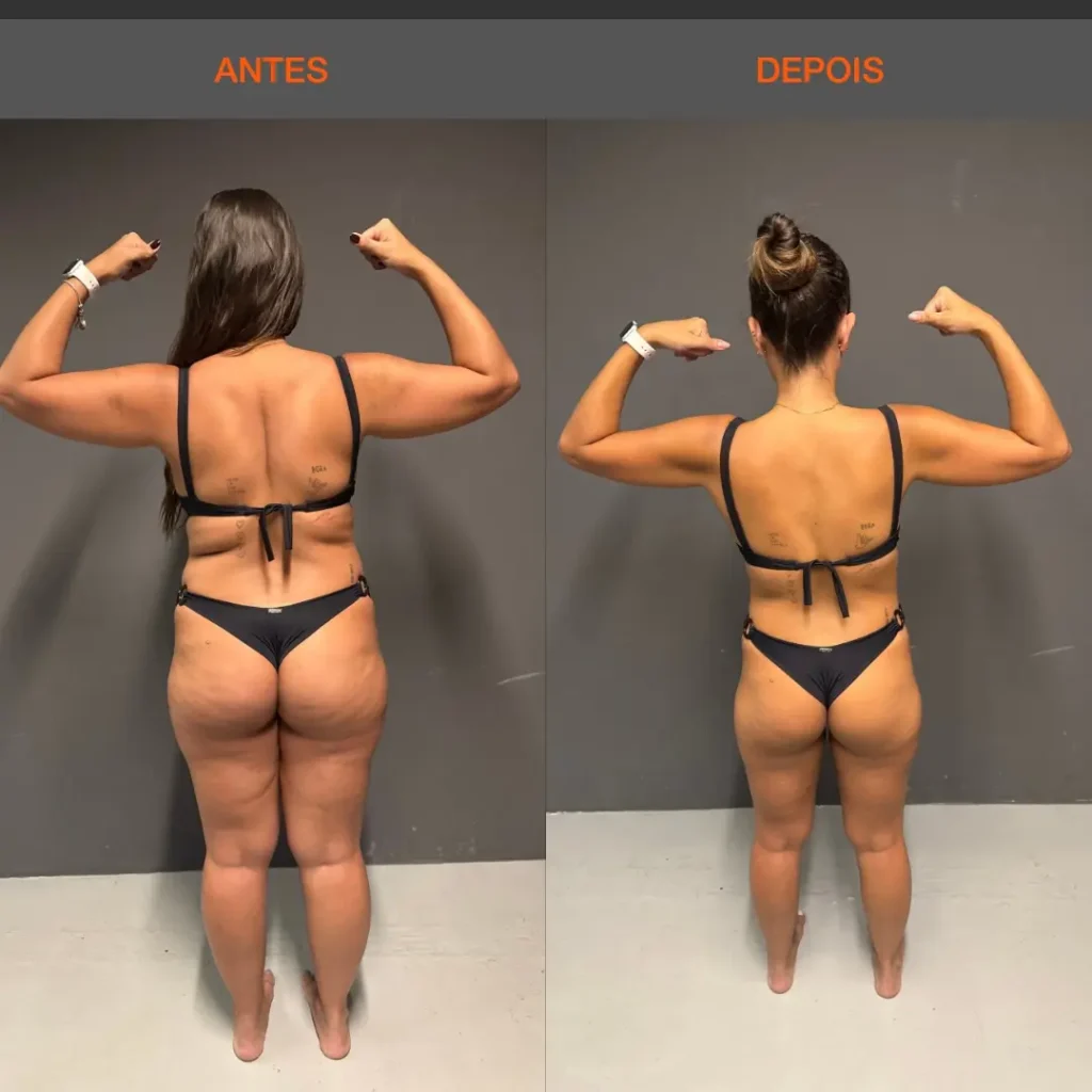 Antes e Depois 09 mulher