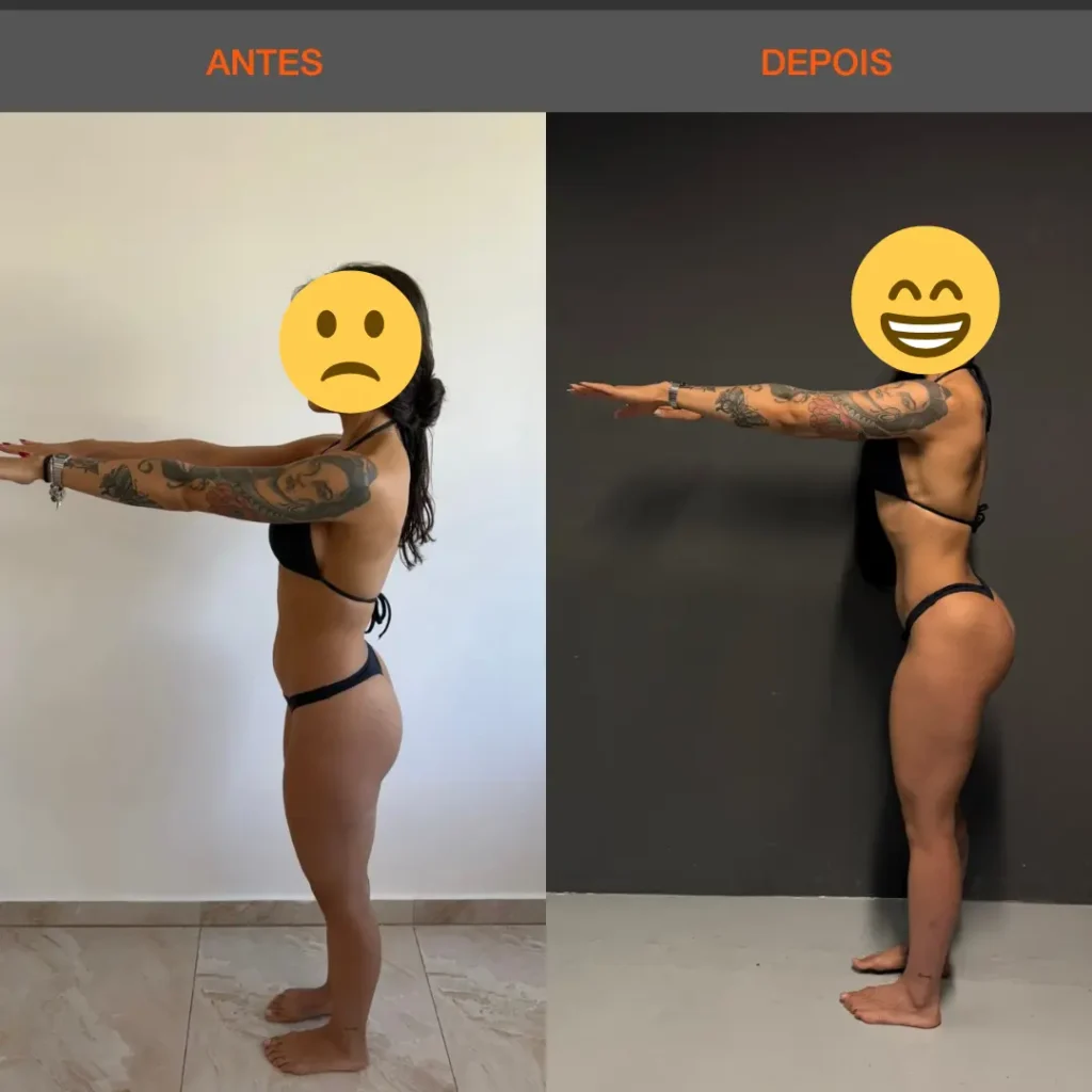 Antes e Depois 13 mulher